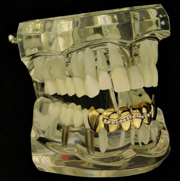 Bling Cartel Admin 14K Gold Plated Wavy Iced Bottom Vampire Fangs Grillz PreStyled Sets