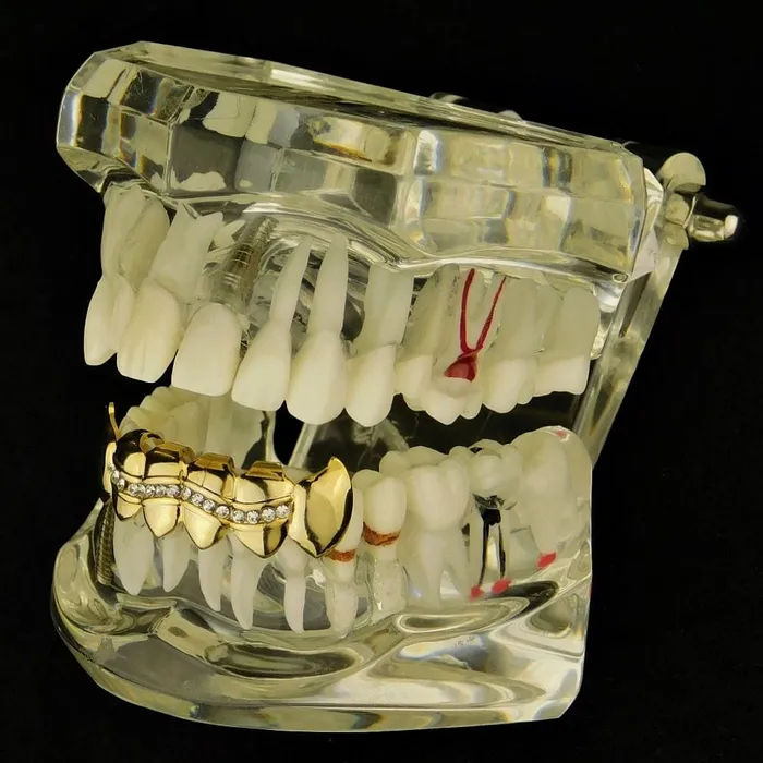 Bling Cartel Admin 14K Gold Plated Wavy Iced Bottom Vampire Fangs Grillz PreStyled Sets