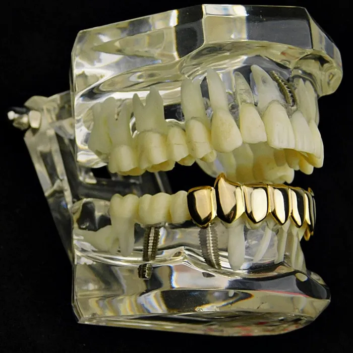 Bling Cartel Admin PreStyled Sets 14K Gold Plated Eight Bottom Teeth Vampire Fangs Grillz
