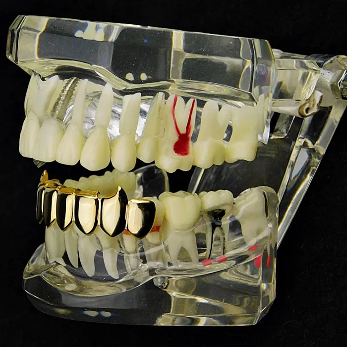 Bling Cartel Admin PreStyled Sets 14K Gold Plated Eight Bottom Teeth Vampire Fangs Grillz