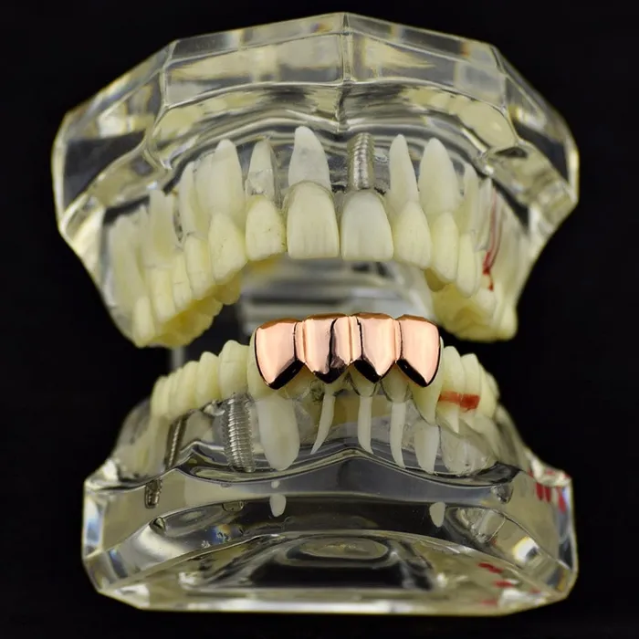Earrings Bling Cartel Admin 14K Rose Gold Plated Four Tooth Bottom Teeth Grillz