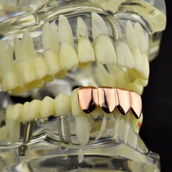Earrings Bling Cartel Admin 14K Rose Gold Plated Four Tooth Bottom Teeth Grillz