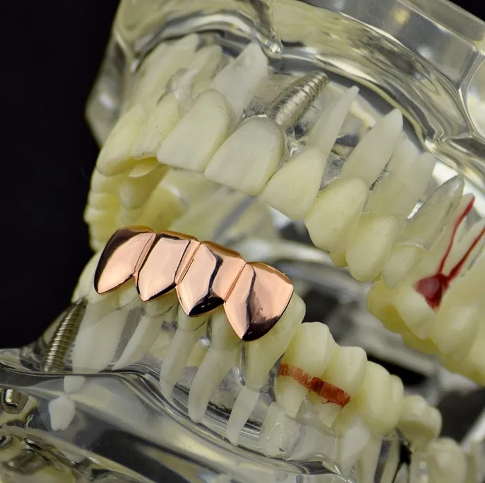 Earrings Bling Cartel Admin 14K Rose Gold Plated Four Tooth Bottom Teeth Grillz