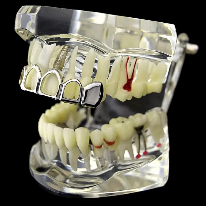 Rings Bling Cartel Admin Silver 4 Open Face Top Teeth Grillz